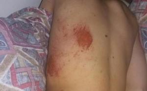 Dva lica uhapšena zbog premlaćivanja mladog Teslićanina 