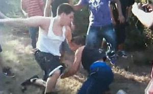 Tuča osnovaca u Prijedoru: Dječak zadobio teške povrede glave