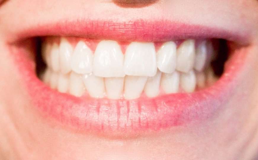 Najbolja preventiva protiv bolesti: Koliko često treba prati zube?