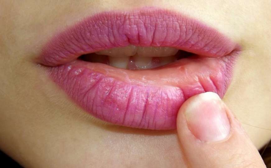 Vaše usne otkrivaju kakvo vam je zdravlje - Pogledajte!