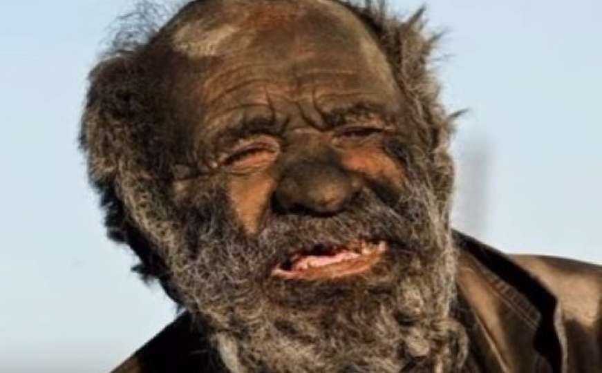 On je najprljaviji čovjek na svijetu: Nije se kupao 60 godina