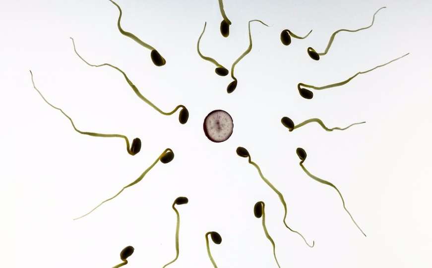 Pogrešnom spermom oplodili 26 žena