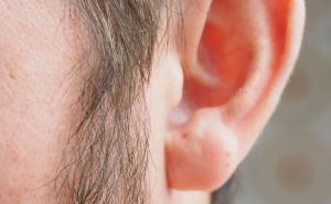 Ne govorite o tome, ali vas nervira: Kako se riješiti dlaka u ušima?