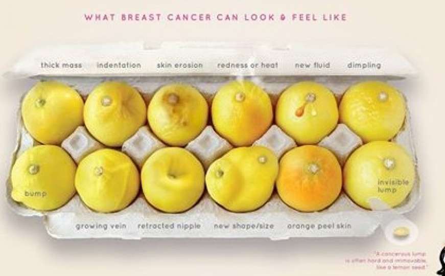 Uz ovu fotografiju žene su otkrile da imaju rak - nemojte zanemariti!
