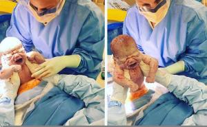 Nevjerovatan trenutak: Mama sama porodila sina tokom carskog reza