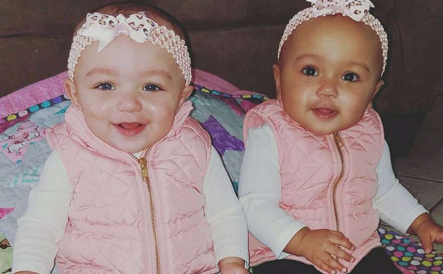 Dupla ljubav: Majka rodila blizanke dvije različite rase