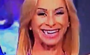 Voditeljici usred emisije ispao zub