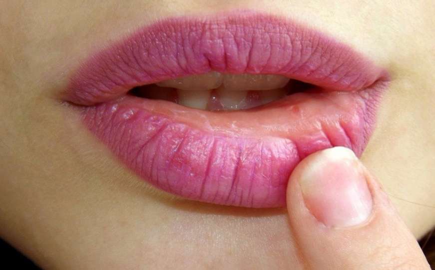Koliko je loše nanositi balzam za usne prstom?