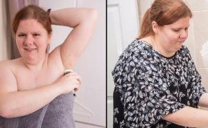 Zbog rijetke bolesti zaudara po mirisu pokvarene ribe