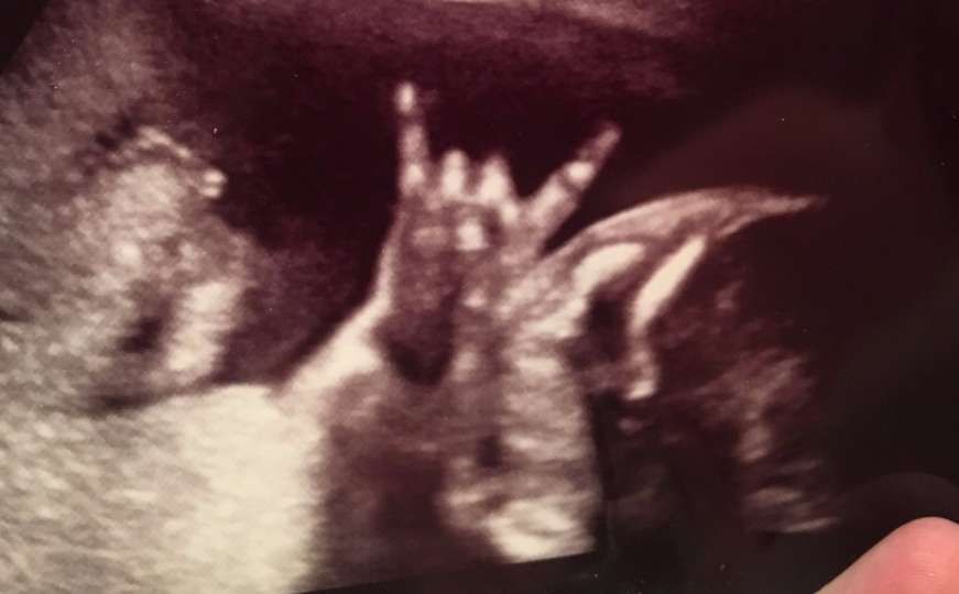 Nevjerovatna fotka s ultrazvuka: Rock 'n' Roll, mali čovječe!
