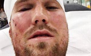 Bivši njemački reprezentativac se potukao i dobio otkaz u Stuttgartu