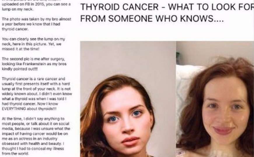 Twitter: Žena na svojoj fotografiji otkrila simptom raka 