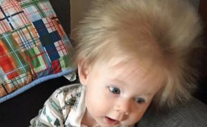 Mališan rođen s takvom kosom da se cijeli svijet zaljubio u njega