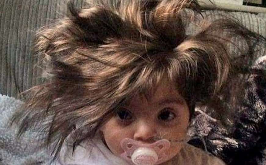 Ova beba ima toliko kose da su svi ubijeđeni da nosi periku