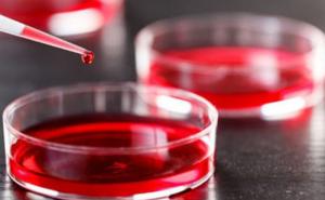 Bolest koja ubija više nego rak debelog crijeva i dojke zajedno