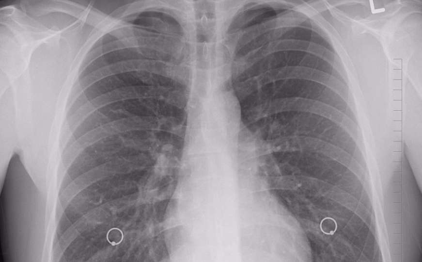 Iznenađujuće otkriće: Pluća ne služe samo za disanje