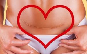 Mame, ako se ste imale carski rez ovo ne smijete raditi 