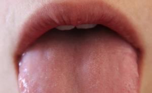 Tri problema koja prijete ako ne peremo i jezik 