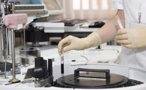 Prepoznajte simptome najgoreg oblika raka: Vrijeme je najbitnije!