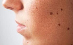 Ljudsko tijelo je nevjerovatno: 10 znakova koji otkrivaju da niste zdravi