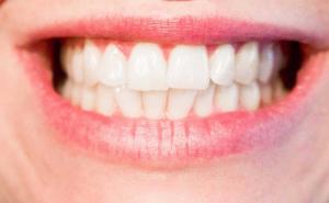 Evo zašto trebate prati zube morskom soli i sodom bikarbonom