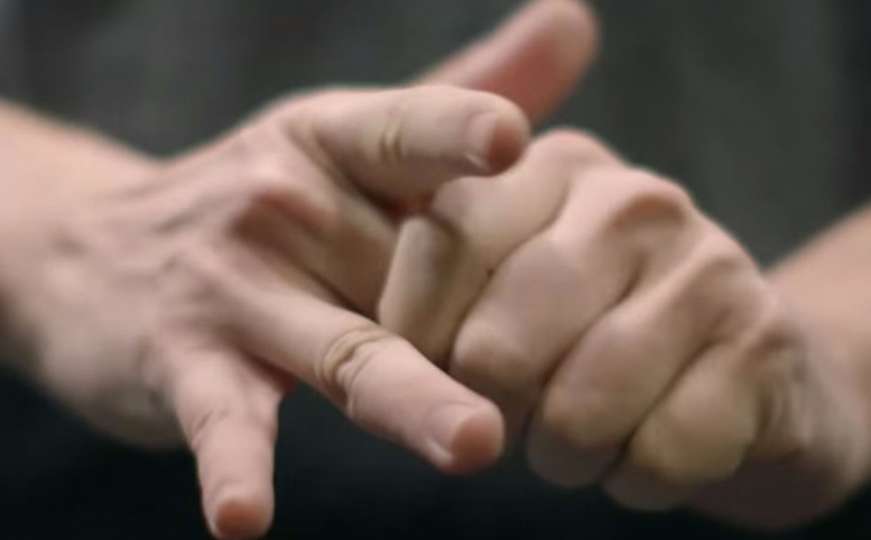 Šta se dešava s vašim zglobovima kada "lomite" prste?