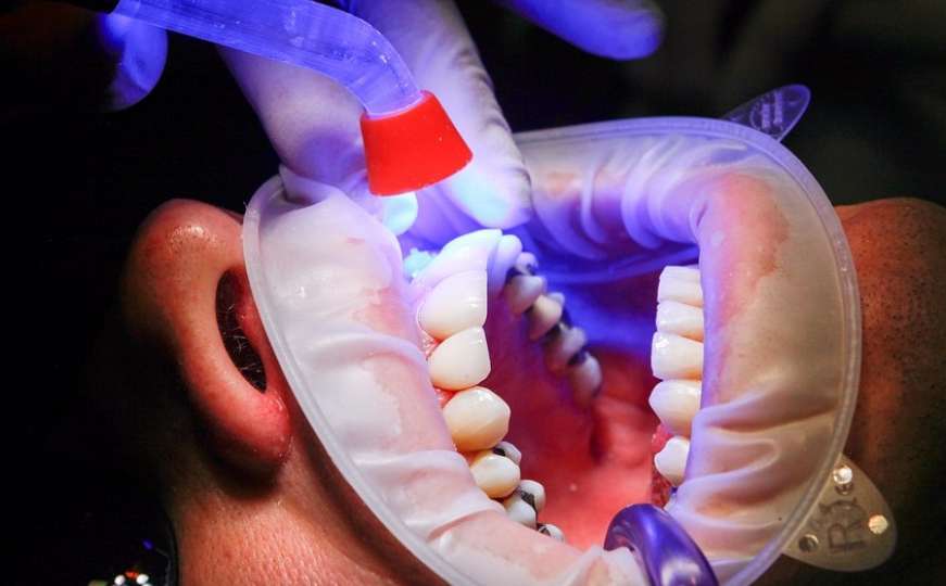 Bol u zubu vam možda ukazuje na bolest drugih organa