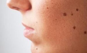 Pet stvari koje nikad ne smijete staviti na lice