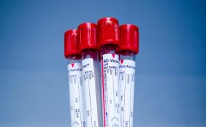 Ljudi s ovom krvnom grupom imaju veću mogućnost za srčane probleme