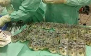 Prevarena žena progutala 7.000 dolara kako bi ih skrila od muža