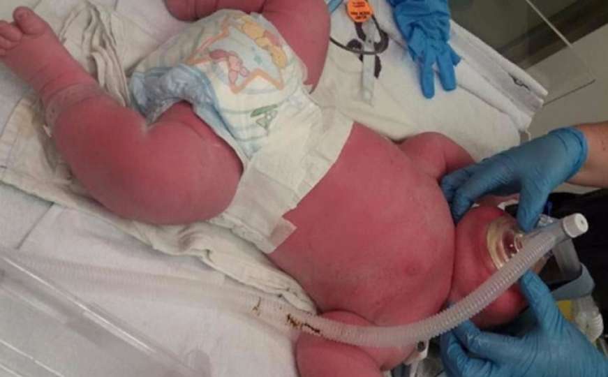 Na Novom Zelandu rođena beba teška 7,39 kilograma