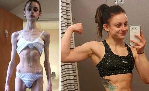 Hrabre žene i muškarci koji su pobijedili anoreksiju