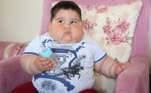 Beba ima samo godinu i po, a teži 32 kilograma