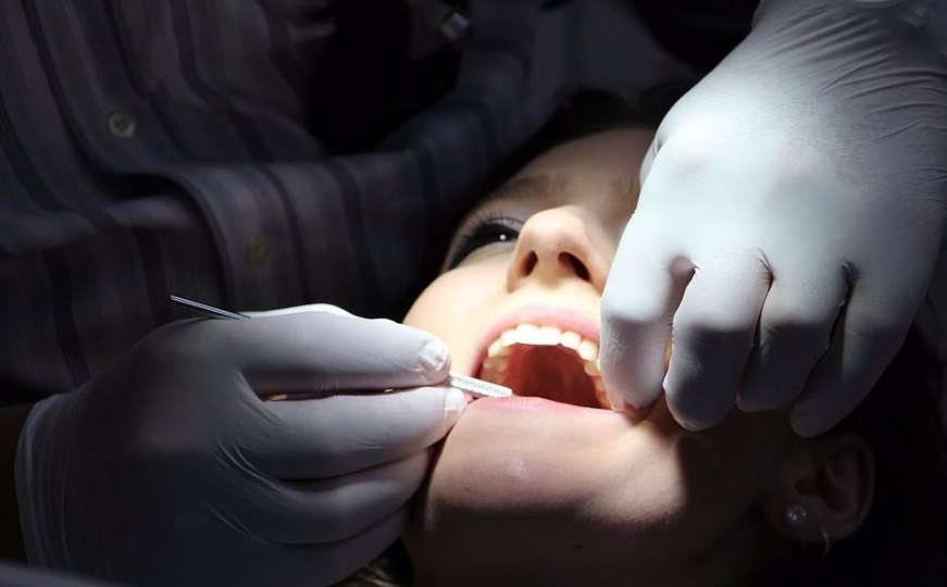 Optužen za prevaru: Stomatolog ženi izvadio 22 zdrava zuba