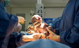 Rijetka pojava: Beba rođena trudna