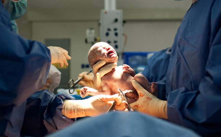 Rijetka pojava: Beba rođena trudna
