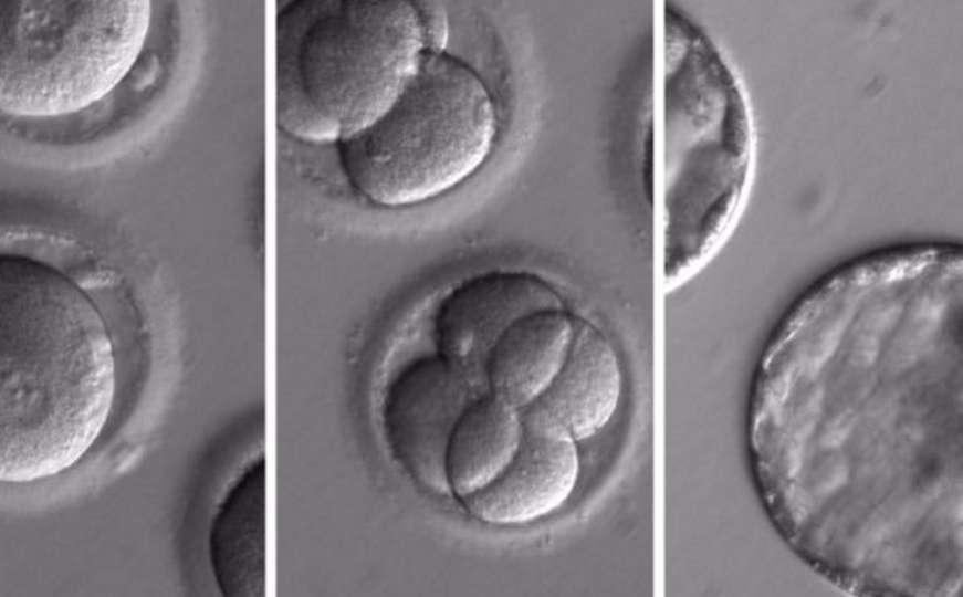 Naučnici na ljudskom embriju 'prepravili' gen koji uzrokuje nasljednu bolest