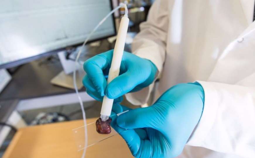 Uređaj veličine olovke za 10 sekundi dijagnosticira rak