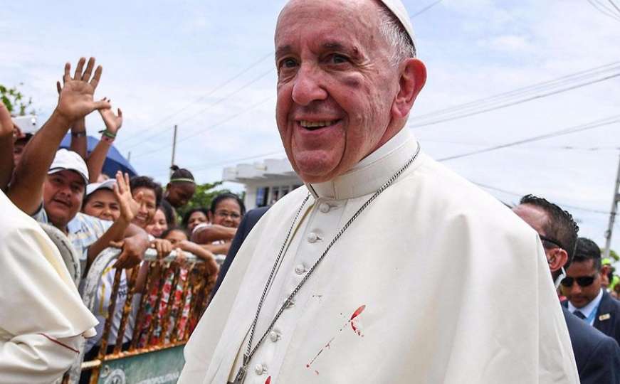 Papa Franjo posrnuo u papamobilu i zadobio modricu kod oka