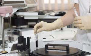 Tri razloga zbog kojih trebate znati svoju krvnu grupu