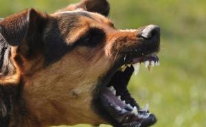 Prijava protiv vlasnika belgijskog ovčara koji je nasrnuo na dijete