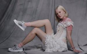 Švedska manekenka slikala se za Adidas nedepiliranih nogu