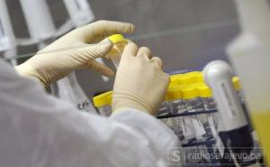 Umrlo 19 osoba u epidemiji hepatitisa A u Californiji