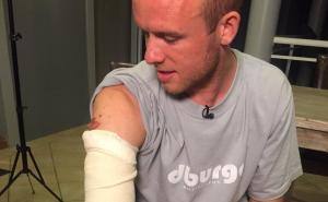 Golim rukama uspio da se odbrani od ajkule: Udario je po njušci