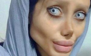 Sarah Tabar željela izgledati kao Angelina i upropastila lice estetskim operacijama