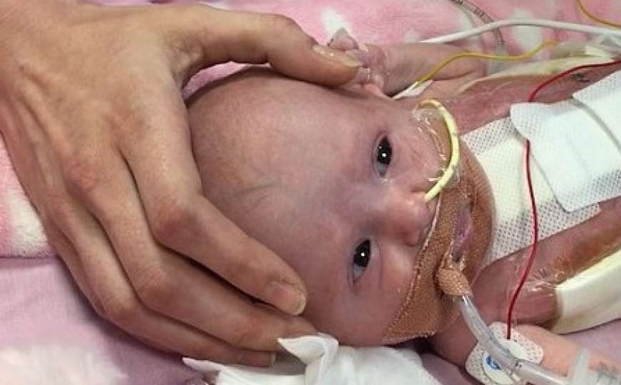 Beba s rijetkim sindromom došla na svijet: Srce joj raste izvan tijela 