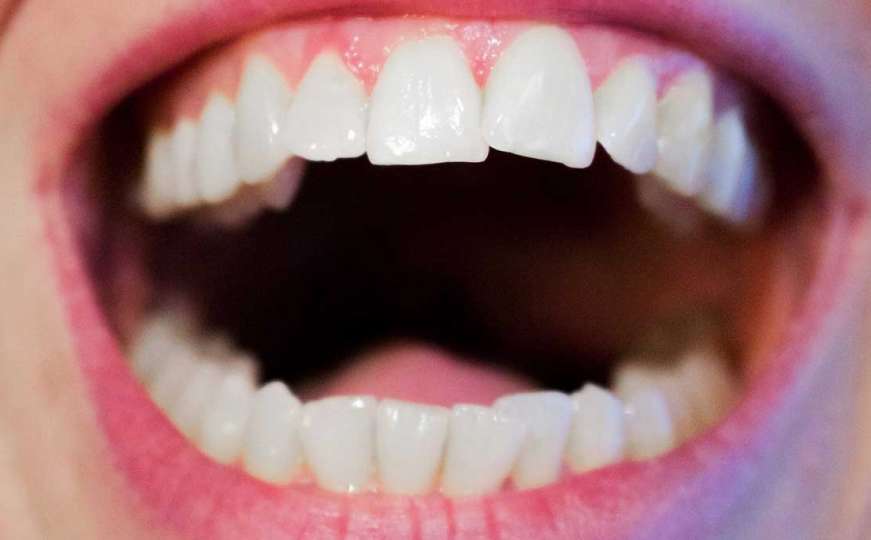 Pet namirnica koje uništavaju zube