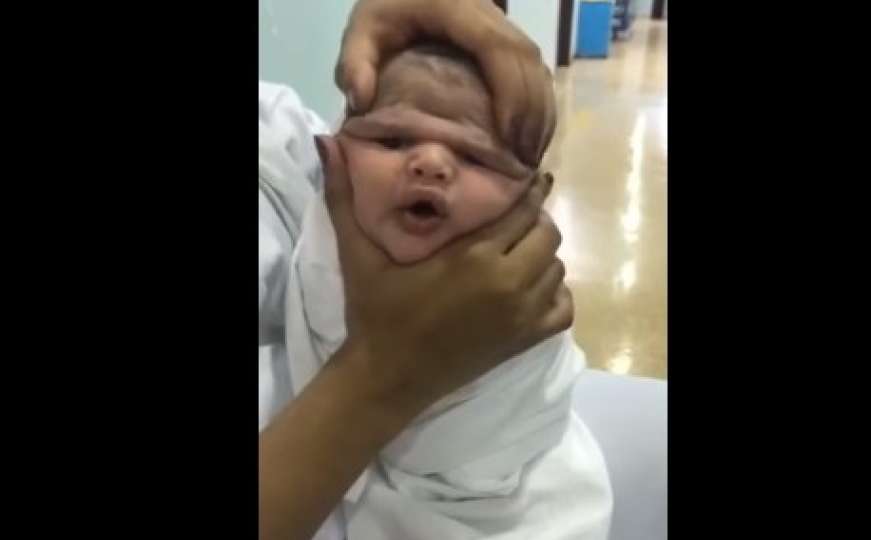 Šokantan snimak: Medicinska sestra se smije i stiska glavu bebe