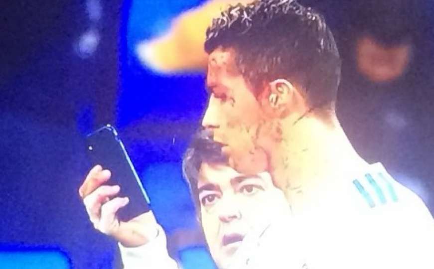 Ronaldo krvav napustio teren pa se ogledao na mobitel