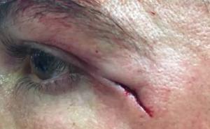 Kako izgleda kada Realovi doktori šiju Ronaldovo lice